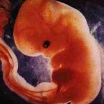 Phát hiện bất thường thai nhi từ 7 tuần tuổi