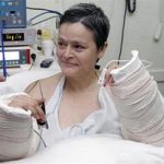 Lại có tay sau 28 năm