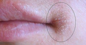 Nhìn vào mép và thấy thứ này, đó là dấu hiệu cơ thể bạn đang “báo động”