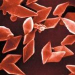Dũng sĩ trừ sâu – Khuẩn Thuring (Bacillus thuringiensis)