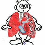 VN có tỉ lệ mắc bệnh phổi mãn tính cao nhất khu vực