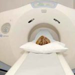 MRI có độ nhạy hơn CT trong chẩn đoán dạng đột quị cấp