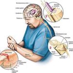 Nhìn nhận mới về cách não bộ định vị cơn đau