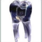 Răng giả có thể gây u bướu