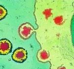 HIV lẩn trốn trong cơ thể như thế nào?