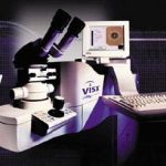 Điều trị mắt bằng laser theo bản đồ giác mạc