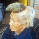 Cụ bà mọc sừng dài kỳ lạ trên đầu