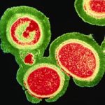 MRSA nguy hiểm hơn HIV