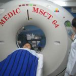 Máy chụp mạch máu toàn thân