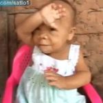 Cô gái 30 tuổi mang hình hài trẻ sơ sinh