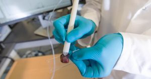 Chiếc bút phát hiện ung thư trong 10 giây