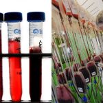 Máu nhân tạo – niềm hi vọng của loài người
