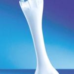 Phụ nữ gần tuổi 30 có nguy cơ bị loãng xương