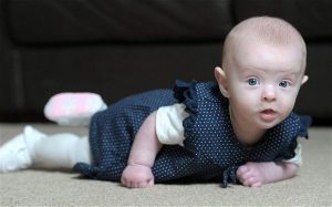 Bé gái “không có máu” sống sót kỳ diệu
