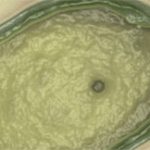 Pandoravirus – liên kết thiếu được phát hiện giữa virus và tế bào