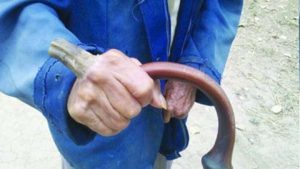 Kỳ lạ ông lão mọc sừng trên tay