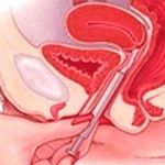 TQ cấm mua bán trứng và tinh trùng bất hợp pháp