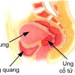Giấm: Thuốc thử ung thư cổ tử cung