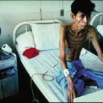 Phát hiện sớm và điều trị lao cho người nhiễm HIV