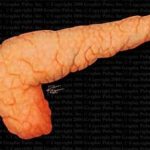 Điều trị thử nghiệm thành công bệnh tiểu đường