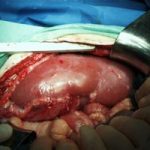 Ghép nội tạng lợn cho… người
