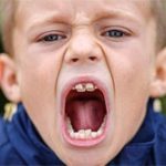 Cậu bé có hàm răng cá mập