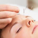 Châm cứu giúp phụ nữ bị ung thư vú giảm mệt mỏi