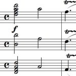 Phát hiện “chìa khóa” ở bản nhạc của Mozart giúp xoa dịu người bệnh động kinh