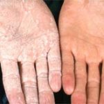 Giải mã hiện tượng “bàn tay bọt biển” kỳ lạ