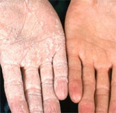 Giải mã hiện tượng “bàn tay bọt biển” kỳ lạ
