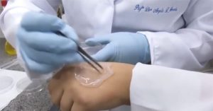 Băng dán làm từ dứa giúp vết thương chóng lành
