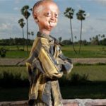 Cậu bé 14 tuổi có gương mặt cụ già