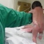 Các bác sĩ giải thích hiện tượng em bé vừa sinh ra đã bước đi