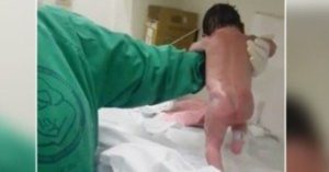 Các bác sĩ giải thích hiện tượng em bé vừa sinh ra đã bước đi