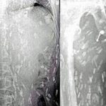 Người đàn ông ăn sashimi thấy ngứa da, chụp ảnh X-quang hình ảnh hiện ra đáng sợ