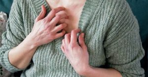 Vì sao mặc quần áo len hay bị ngứa?