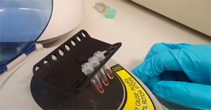 Kit thử SARS-CoV-2 nhanh gấp 3 lần bình thường
