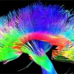 Họa sĩ có cấu trúc não bộ khác với người thường