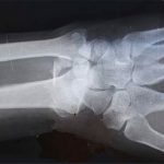 Bí ẩn những bộ xương khỏe nhất thế giới