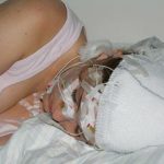 Truyền điện vào não để tăng cường trí nhớ