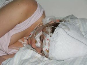 Truyền điện vào não để tăng cường trí nhớ