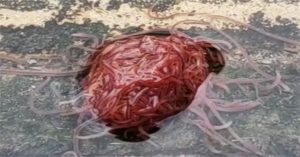 Rùng mình “búi giun” như bộ não người