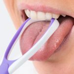 Không làm sạch lưỡi khi đánh răng nguy hiểm thế nào?