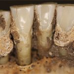 Cao răng tiết lộ thói quen dùng thuốc của người xưa