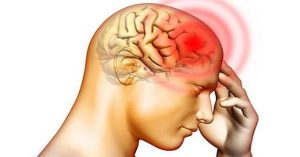 Bệnh phù não: Nguyên nhân, triệu chứng và cách điều trị