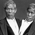 Cuộc đời gây tò mò của cặp song sinh dính liền 200 năm trước