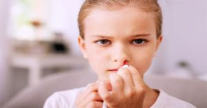 Chảy máu cam – cần chú ý những gì?