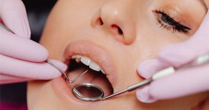 Những sự thật ít người biết về sâu răng