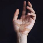 Căn bệnh kỳ lạ khiến người mắc vô cảm với cơn đau