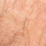 Phát triển thành công da từ tế bào gốc có thể được cấy ghép và mọc lông